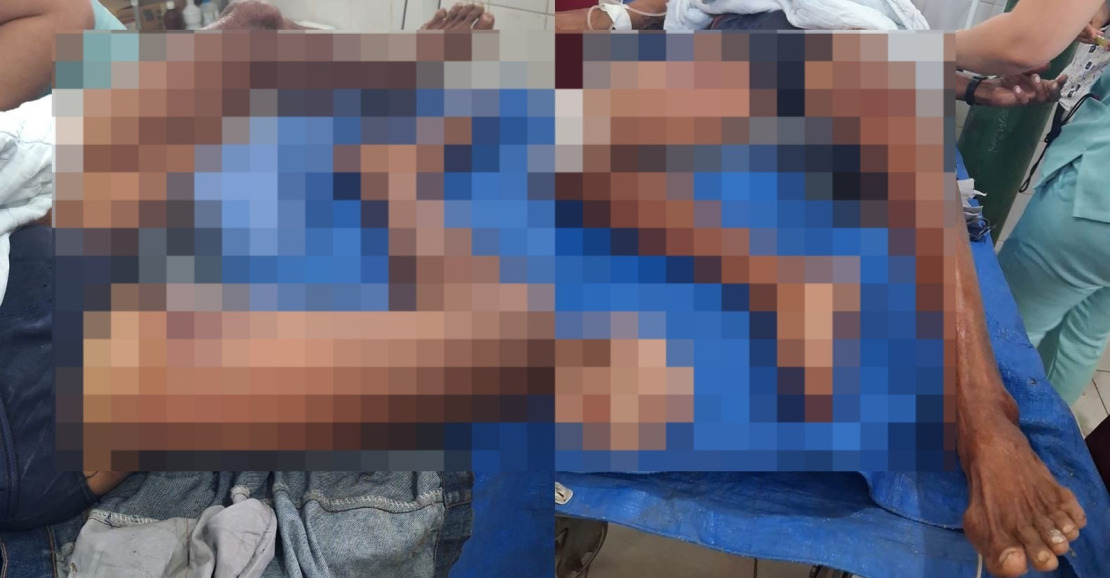 Idoso Amarrado Após Assalto em Óbidos Morre e Caso é Tratado como Latrocínio