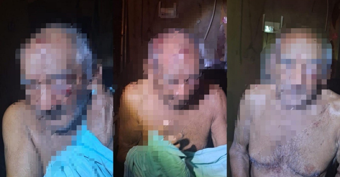 Aumento da Violência contra Idosos em Óbidos: Caso de Agressão com Pedras e Madeira