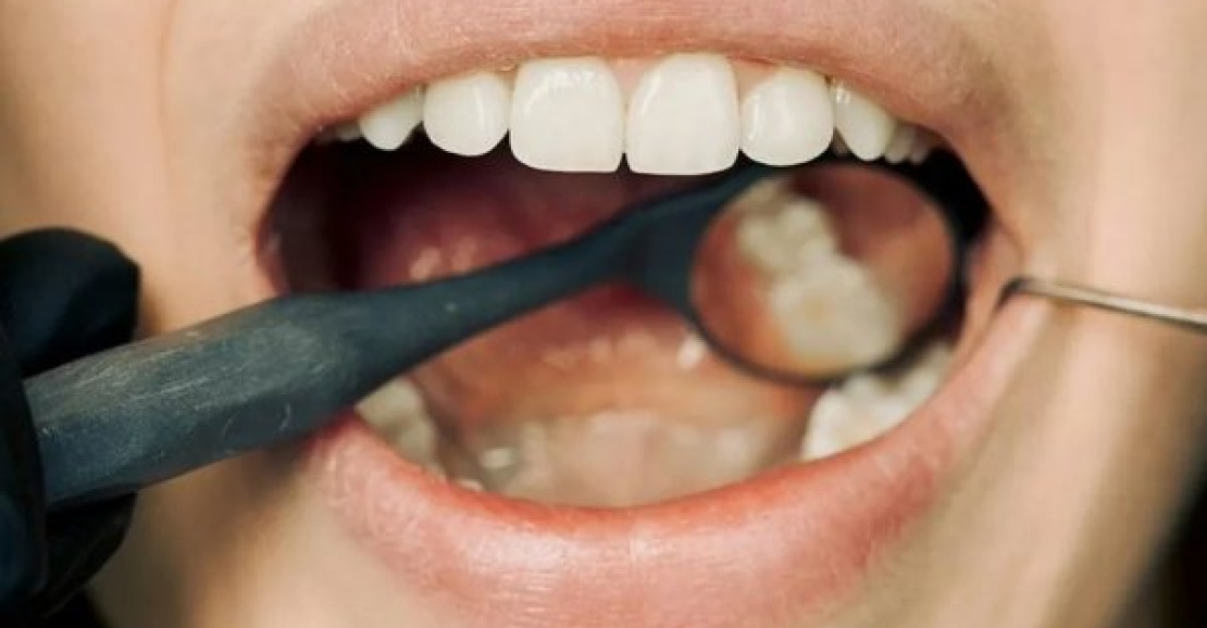 ONG promove megatriagem odontológica gratuita para jovens em 150 cidades