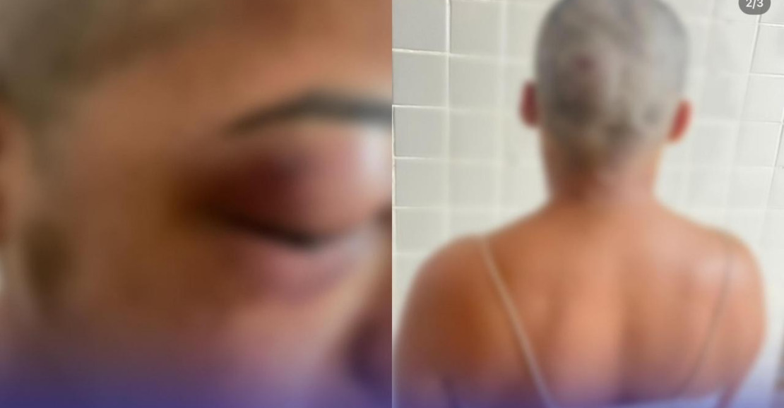Mulher é vítima de agressões e atentado a tiros em Almeirim, PA